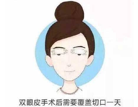 上海帝妍迎采医疗美容科普全切双眼皮