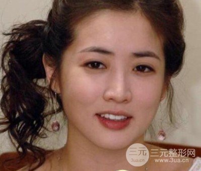 崔贞媛整容前后差别大吗