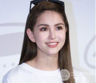 昆凌整容了吗