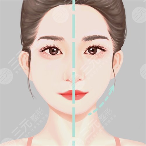 成都军大整形医院脂肪填充案例