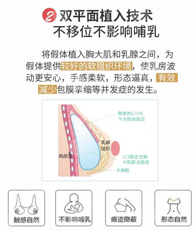隆胸手术