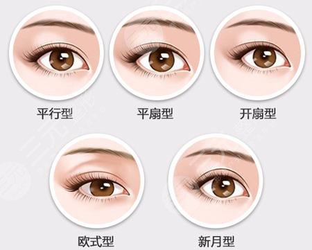 吴桐医生科普割双眼皮手术知识