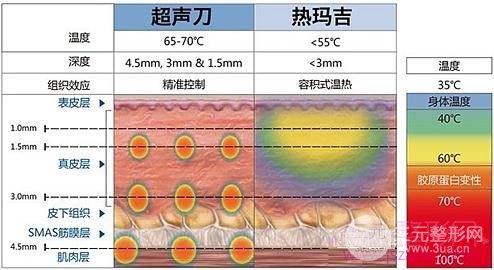 热拉提和热玛吉的区别