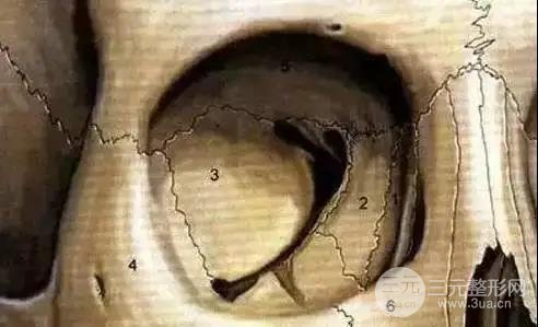 眼睛整形