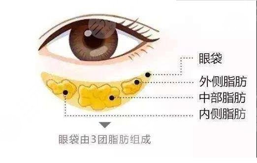 聚能美雕去眼袋原理介绍
