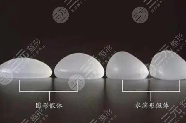假体隆胸