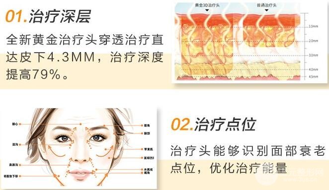 热玛吉的常见问题
