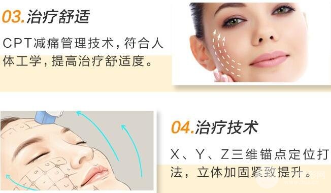 热玛吉的常见问题