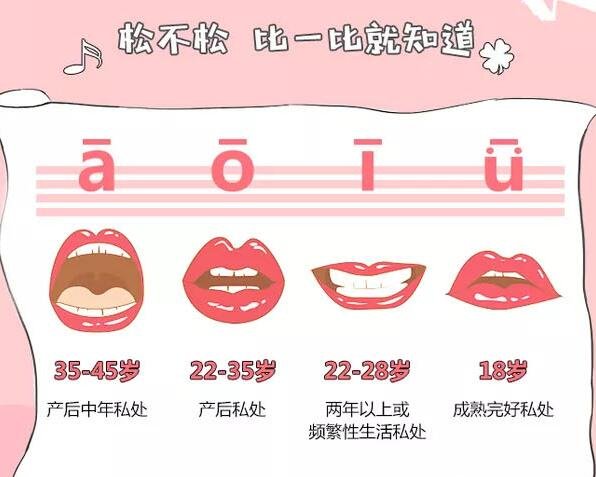 阴道松弛