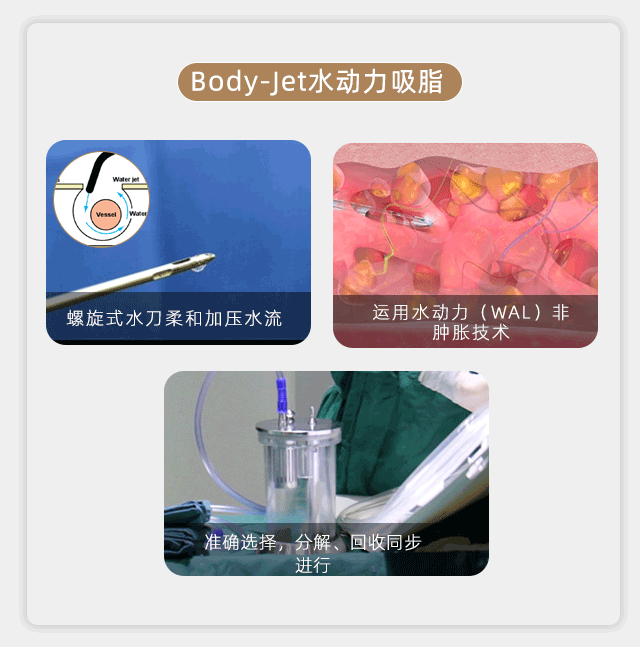 五种术式比较