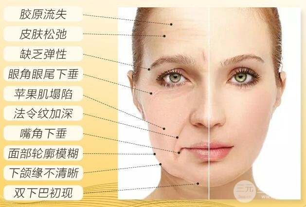 我有上述问题，适合做热玛吉吗?