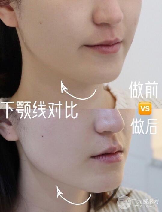 治疗后5个月的体验者档案