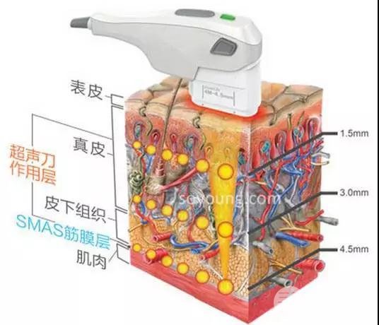 热拉提