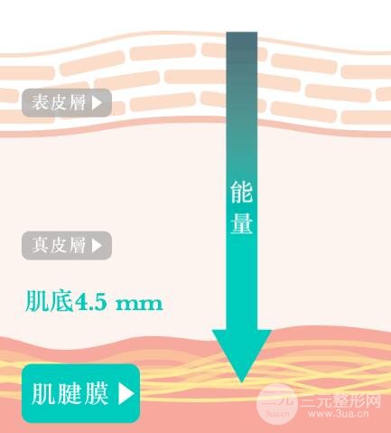 热拉提和热玛吉的区别