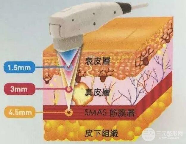 热拉提和热玛吉的区别