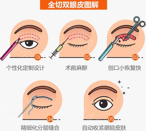 武汉蜜司整形医院科普整形知识