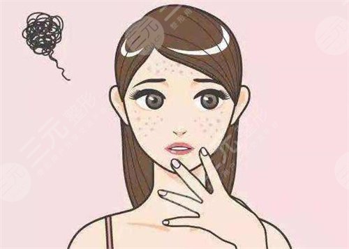 面部奥美定取出方法有哪些
