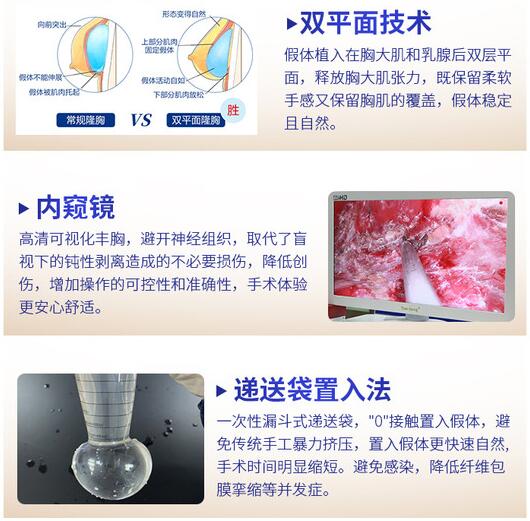 唐新辉 深圳隆胸专家技术