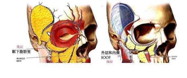 黄多多长大后泪沟黑眼圈全消？是做了整形吗？