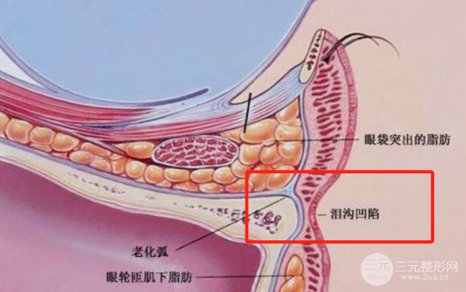 黄多多长大后泪沟黑眼圈全消？是做了整形吗？