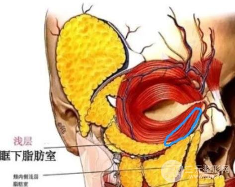 黄多多长大后泪沟黑眼圈全消？是做了整形吗？