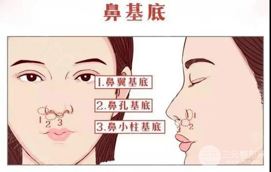 鼻基底做完长小胡子,看完这篇你还敢做吗?