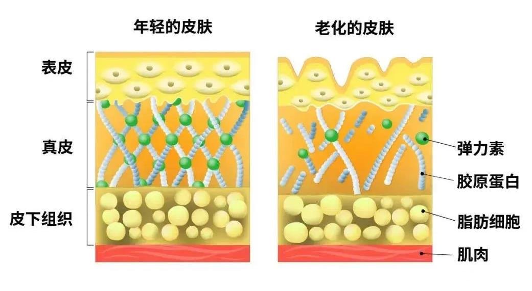 深度解读丨热玛吉和热拉提哪个果好?是时候扒一扒了~