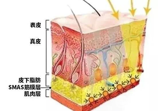 深度解读丨热玛吉和热拉提哪个果好?是时候扒一扒了~