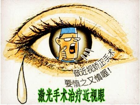 近视眼手术果