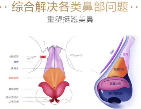 杭州华山医院科普隆鼻
