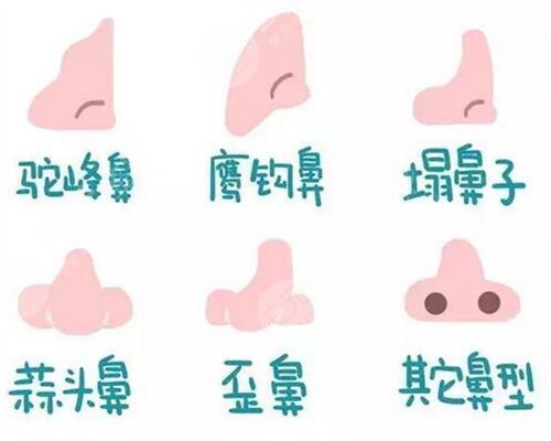 杭州华山医院科普隆鼻