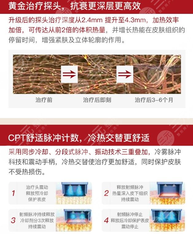 奇致整形美容医院科普热玛吉