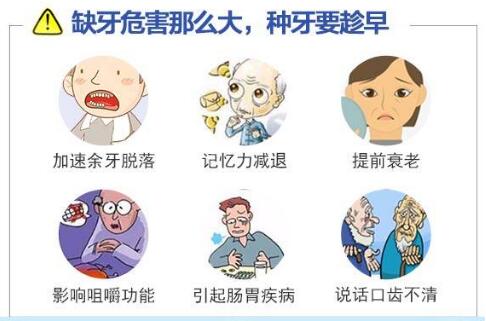 上海美奥口腔科普牙齿种植手术