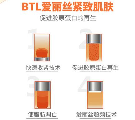btl射频溶脂