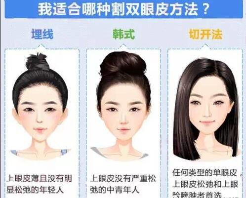 唐山润泽颜医疗整形医院科普双眼皮整形