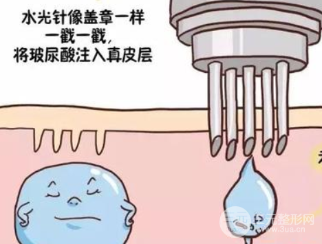 激光治疗黄褐斑有副作用吗