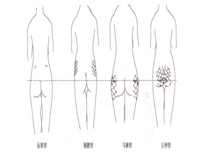 提臀瘦腿方法