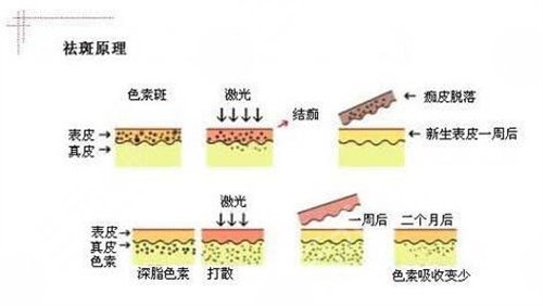 彩光嫩肤要多少钱