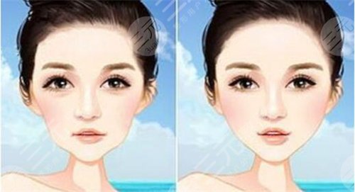 光子嫩肤注意事项是什么?肤白貌美离你不远啦!