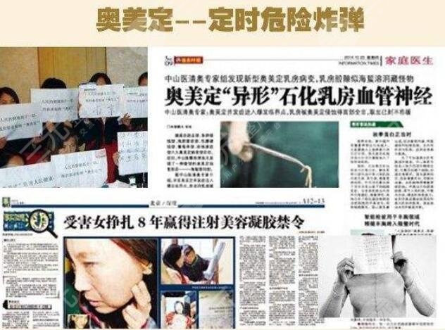 奥美定的危害与并发症科普