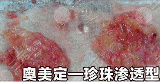 奥美定致癌