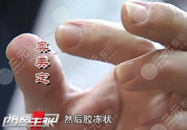 奥美定取出的方式有哪些