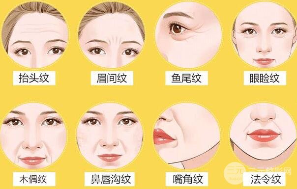 皱纹