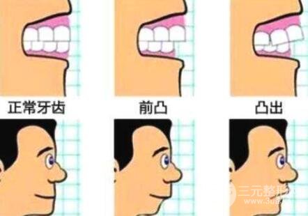 任何人都需要整牙吗?