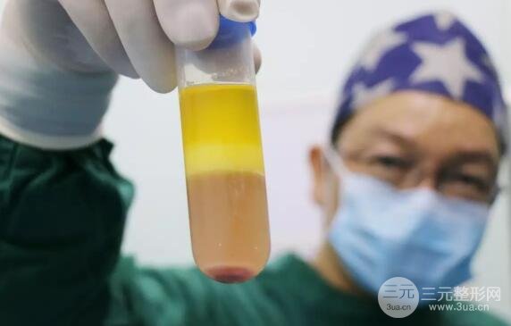 为什么有些人只做一次，而其他人做两三次?