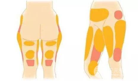 电子吸脂减肥手术价格是多少?