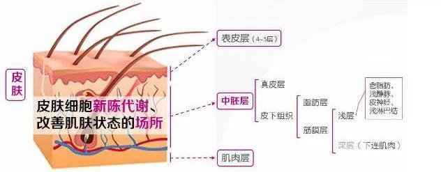 中胚层疗法