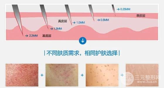 抗衰除皱方法