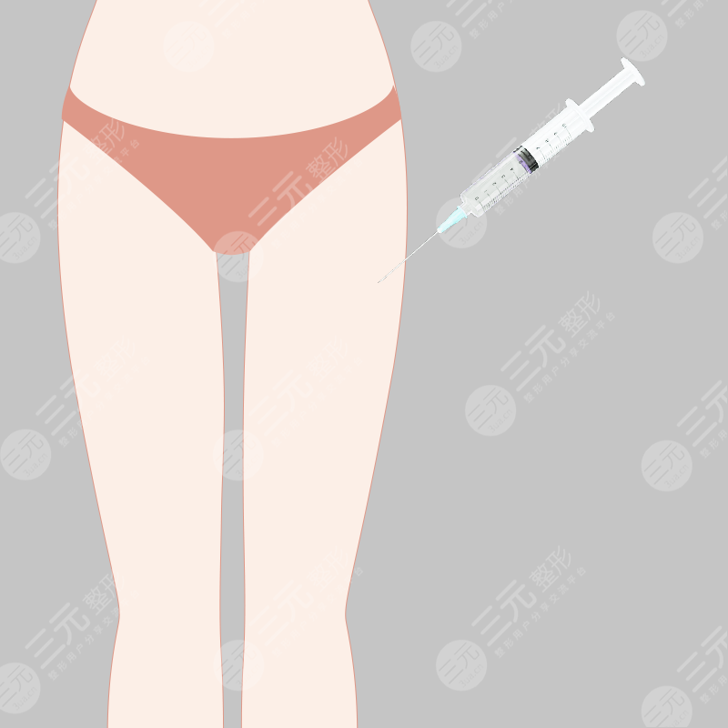 大腿溶脂果图