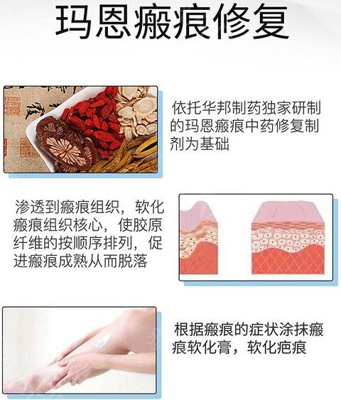 福州玛恩